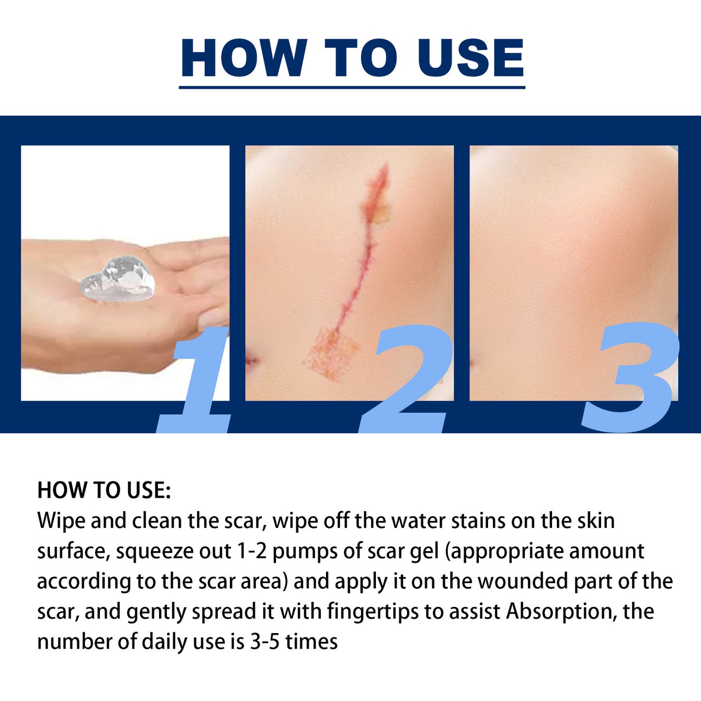 Scar Gel Scar Cream for Surgical Scars C-Section Stretch Marks Acne Injury Burns Keloids Hypertrophic For Old & New Scars