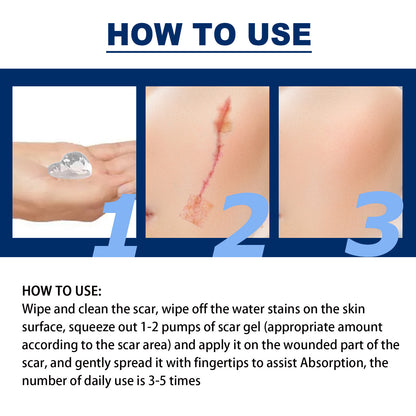 Scar Gel Scar Cream for Surgical Scars C-Section Stretch Marks Acne Injury Burns Keloids Hypertrophic For Old & New Scars