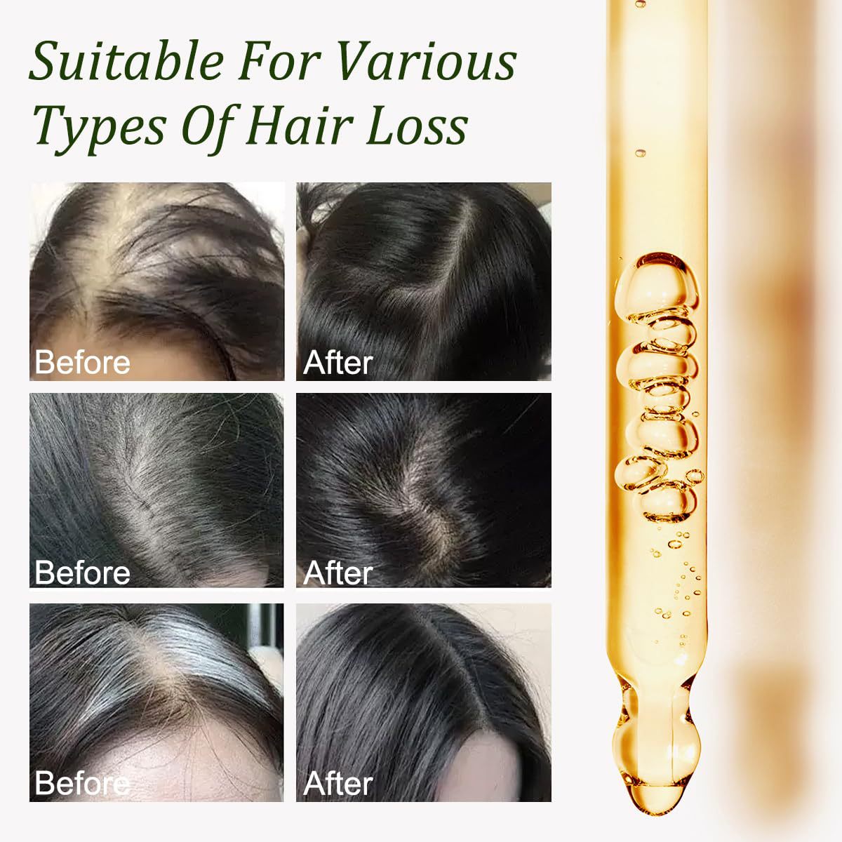 Batana Oil for Hair Growth -100% Pure Natural Hair Growth Oil,Nourishes The Scalp, Eliminates Split Ends