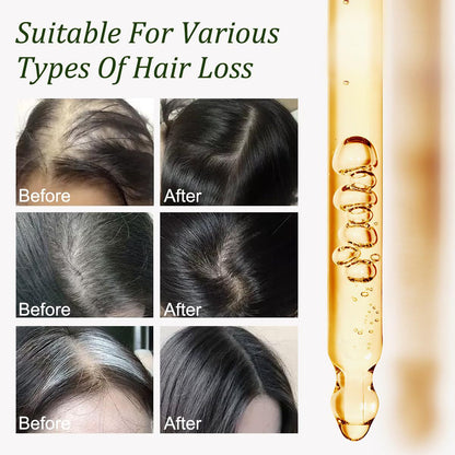 Batana Oil for Hair Growth -100% Pure Natural Hair Growth Oil,Nourishes The Scalp, Eliminates Split Ends
