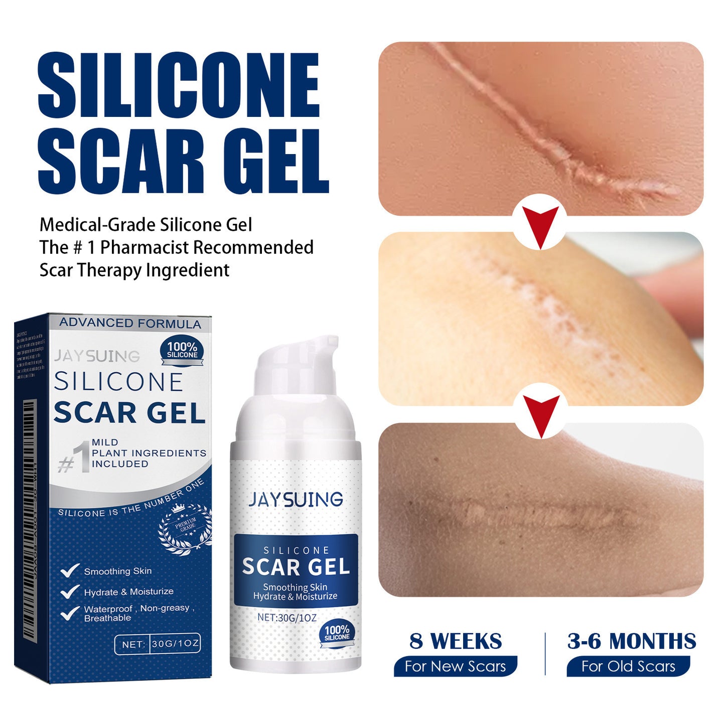 Scar Gel Scar Cream for Surgical Scars C-Section Stretch Marks Acne Injury Burns Keloids Hypertrophic For Old & New Scars
